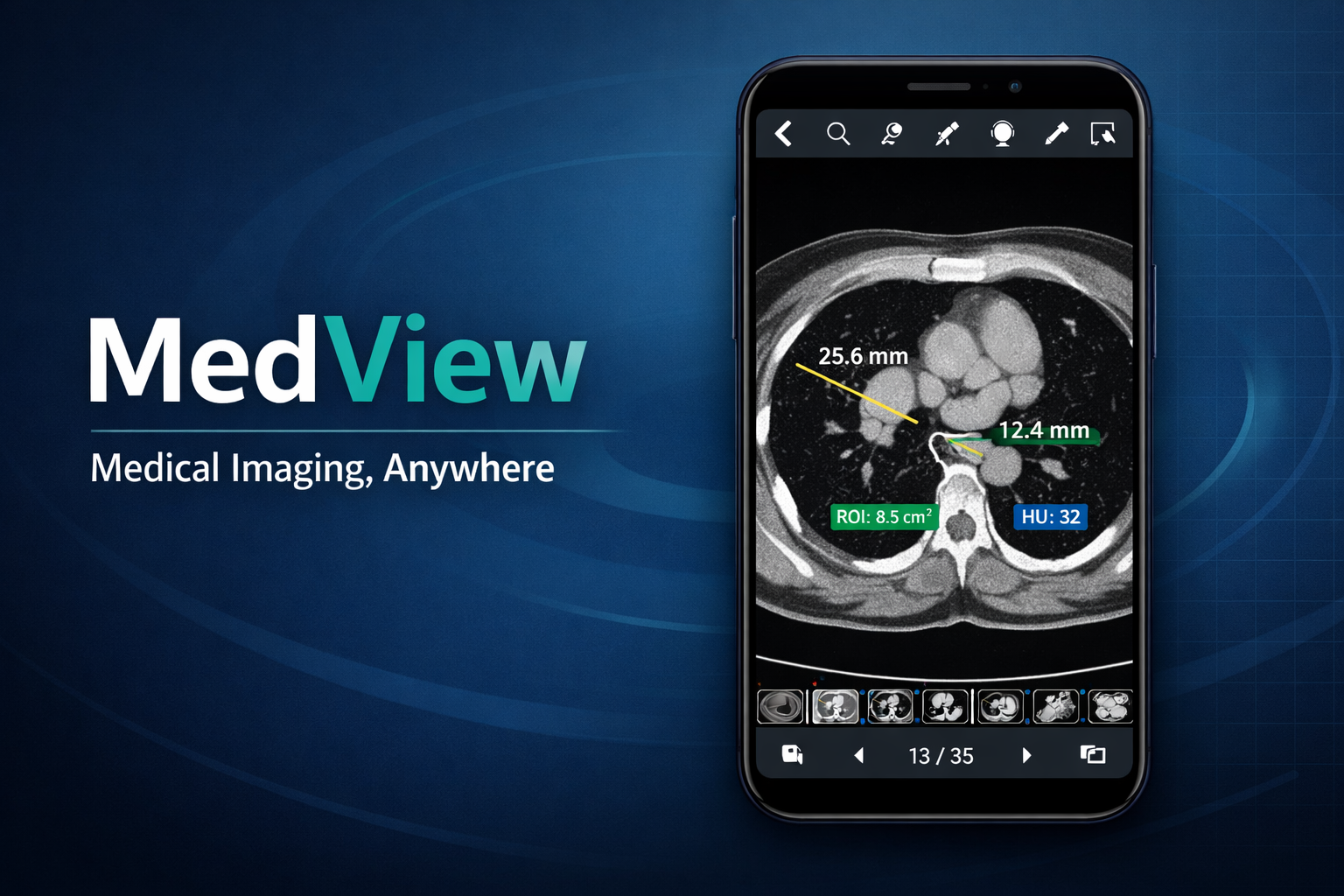 MedView